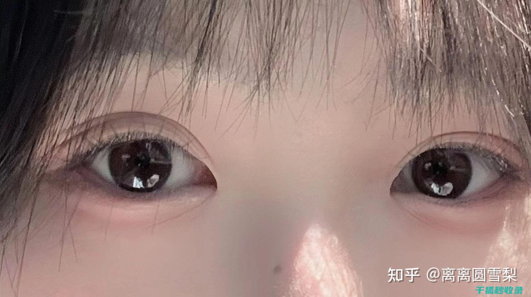 长时间用眼后，眼疲劳怎么办？ (长时间用眼后眼睛有异物感)